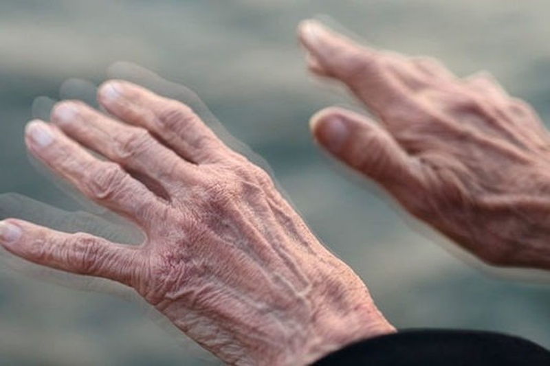 Brasil pode ter mais 1 milhão de pessoas com Parkinson em 2060