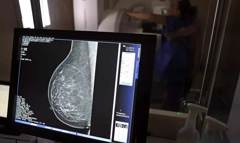 Planos de saúde terão que cobrir mamografia digital sem limite de idade